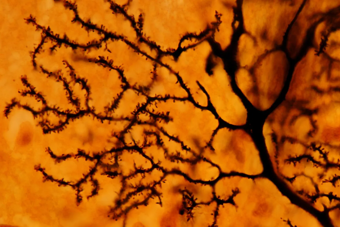 The dendritic tree of a Purkinje neuron is stained with the silver Golgi method